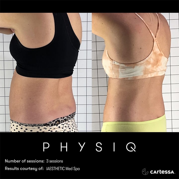 PHYSIQ