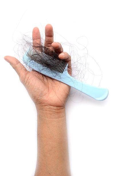 Male and Female Pattern Baldness